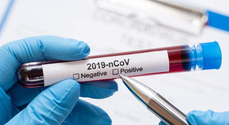 folha-vitoria-04072021171950711 (1)