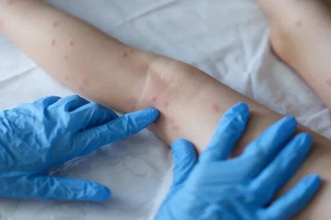 91a7f710-e829-11ec-a0ff-51a635968531--minified